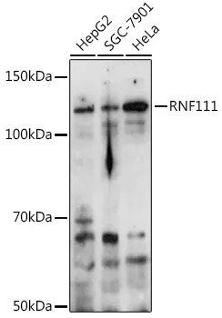 RNF111 Rabbit Polyclonal Antibody - image 1