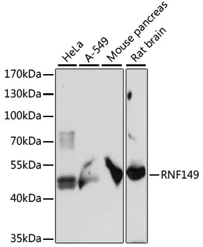 RNF149 Rabbit Polyclonal Antibody - image 1