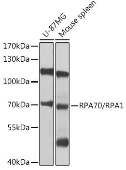 RPA70 (RPA1) Rabbit Polyclonal Antibody - image 1