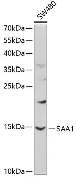 Serum Amyloid A (SAA1) Rabbit Polyclonal Antibody - image 1