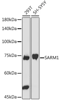 SARM (SARM1) Rabbit Polyclonal Antibody - image 1