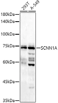 epithelial Sodium Channel alpha (SCNN1A) Rabbit Polyclonal Antibody - image 1