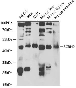 SCRN2 Rabbit Polyclonal Antibody - image 1