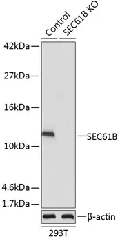 SEC61B Rabbit Polyclonal Antibody - image 1