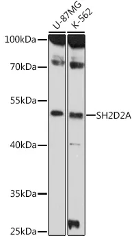 SH2D2A Rabbit Polyclonal Antibody - image 1