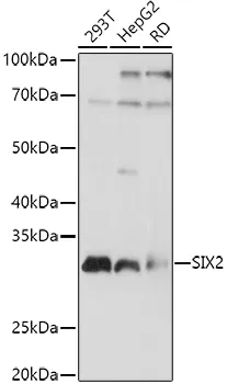 SIX2 Rabbit Polyclonal Antibody - image 1