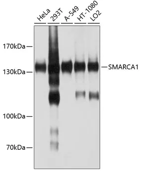 SMARCA1 Rabbit Polyclonal Antibody - image 1