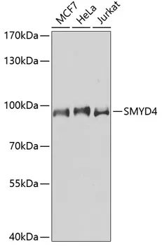SMYD4 Rabbit Polyclonal Antibody - image 1