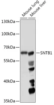 Syntrophin (SNTB1) Rabbit Polyclonal Antibody - image 1