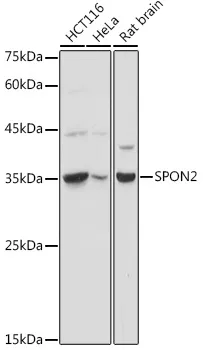 SPON2 Rabbit Polyclonal Antibody - image 1