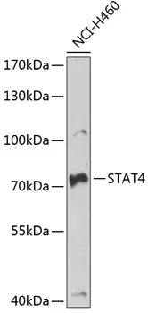 STAT4 Rabbit Polyclonal Antibody - image 1