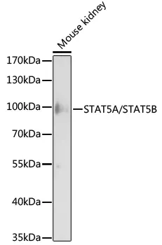 STAT5A Rabbit Polyclonal Antibody - image 1
