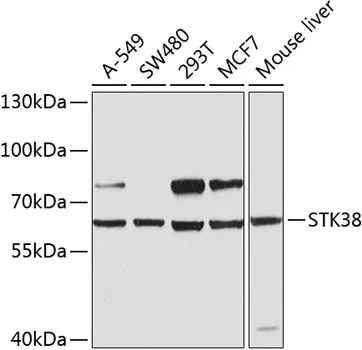 STK38 Rabbit Polyclonal Antibody - image 1