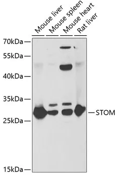 STOM Rabbit Polyclonal Antibody - image 1