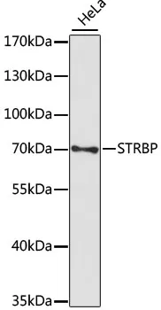 STRBP Rabbit Polyclonal Antibody - image 1