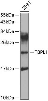 TBPL1 Rabbit Polyclonal Antibody - image 1