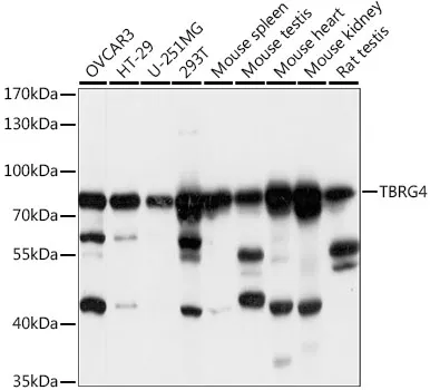 TBRG4 Rabbit Polyclonal Antibody - image 1