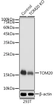 TOMM20 Rabbit Polyclonal Antibody - image 1