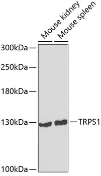 TRPS1 Rabbit Polyclonal Antibody - image 1