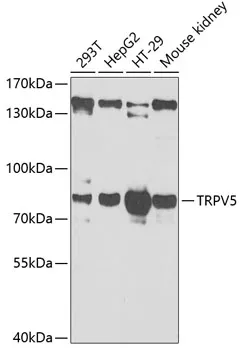 TRPV5 Rabbit Polyclonal Antibody - image 1