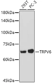 TRPV6 Rabbit Polyclonal Antibody - image 1