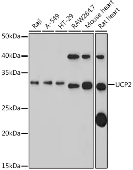 UCP2 Rabbit Polyclonal Antibody - image 1