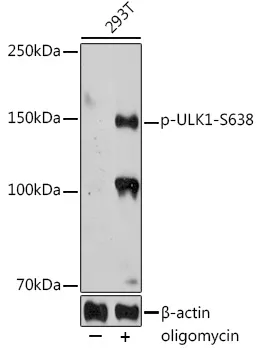 ULK1 Rabbit Polyclonal Antibody - image 1