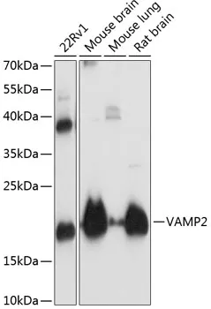 VAMP2 Rabbit Polyclonal Antibody - image 1