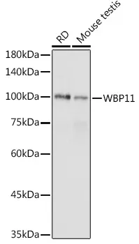 WBP11 Rabbit Polyclonal Antibody - image 1