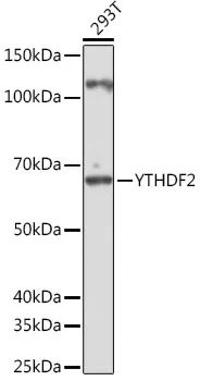 YTHDF2 Rabbit Polyclonal Antibody - image 1