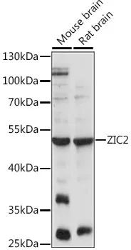 ZIC2 Rabbit Polyclonal Antibody - image 1