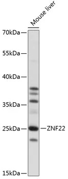 ZNF22 Rabbit Polyclonal Antibody - image 1
