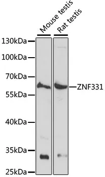 ZNF331 Rabbit Polyclonal Antibody - image 1