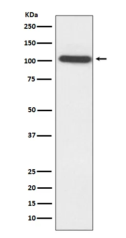 ACTN2 Rabbit Polyclonal Antibody - image 1