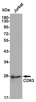 CD63 Rabbit Polyclonal Antibody - image 1