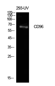 CD96 Rabbit Polyclonal Antibody - image 1