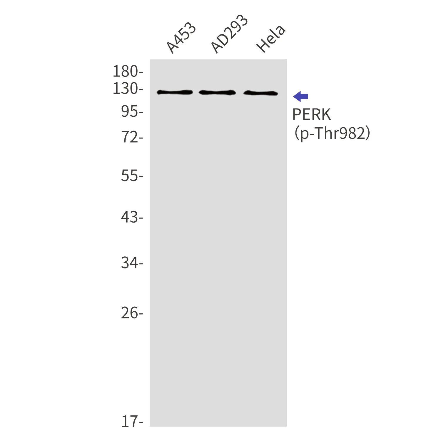 PERK (EIF2AK3) Rabbit Polyclonal Antibody - image 1