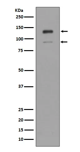 IFNAR1 Rabbit Polyclonal Antibody - image 1