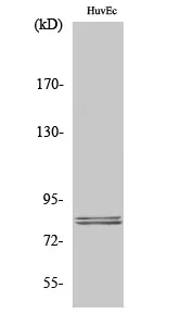 Hormone sensitive lipase (LIPE) Rabbit Polyclonal Antibody - image 1
