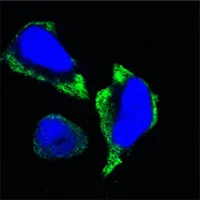 PAK2 Mouse Monoclonal Antibody [Clone ID: 7H3-E2-F5] - image 1