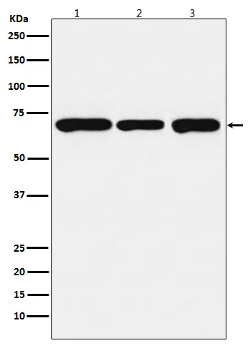 PCK2 Rabbit Polyclonal Antibody - image 1