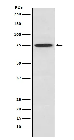 PKC theta (PRKCQ) Rabbit Polyclonal Antibody - image 1