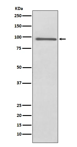 PROX1 Rabbit Polyclonal Antibody - image 1