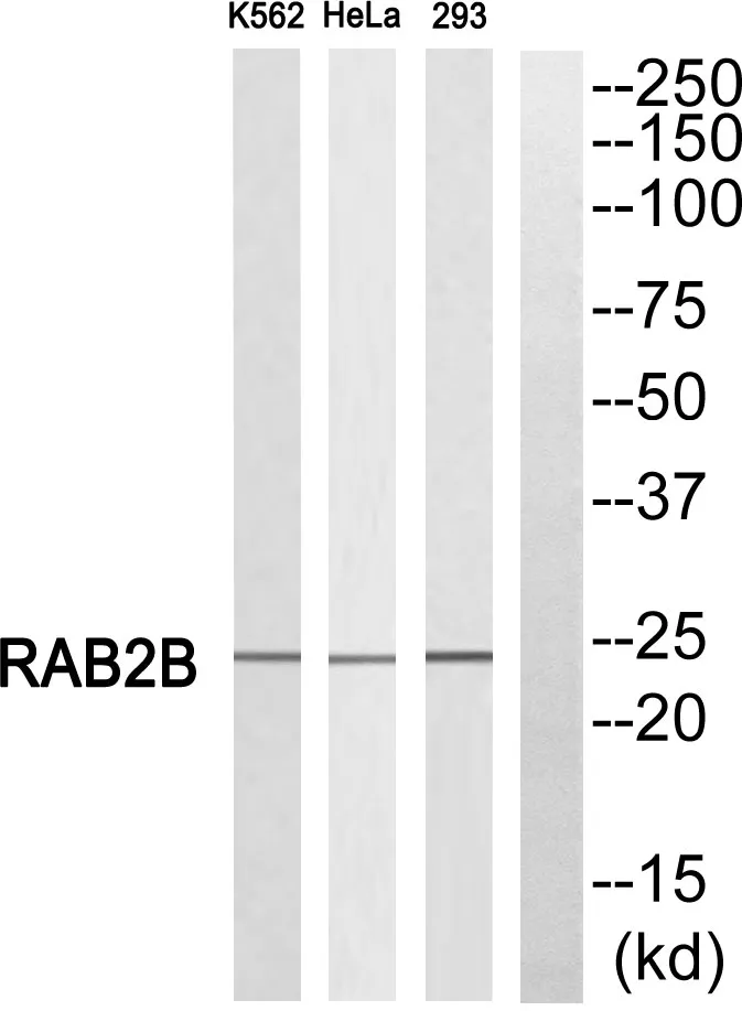RAB2B Rabbit Polyclonal Antibody - image 1