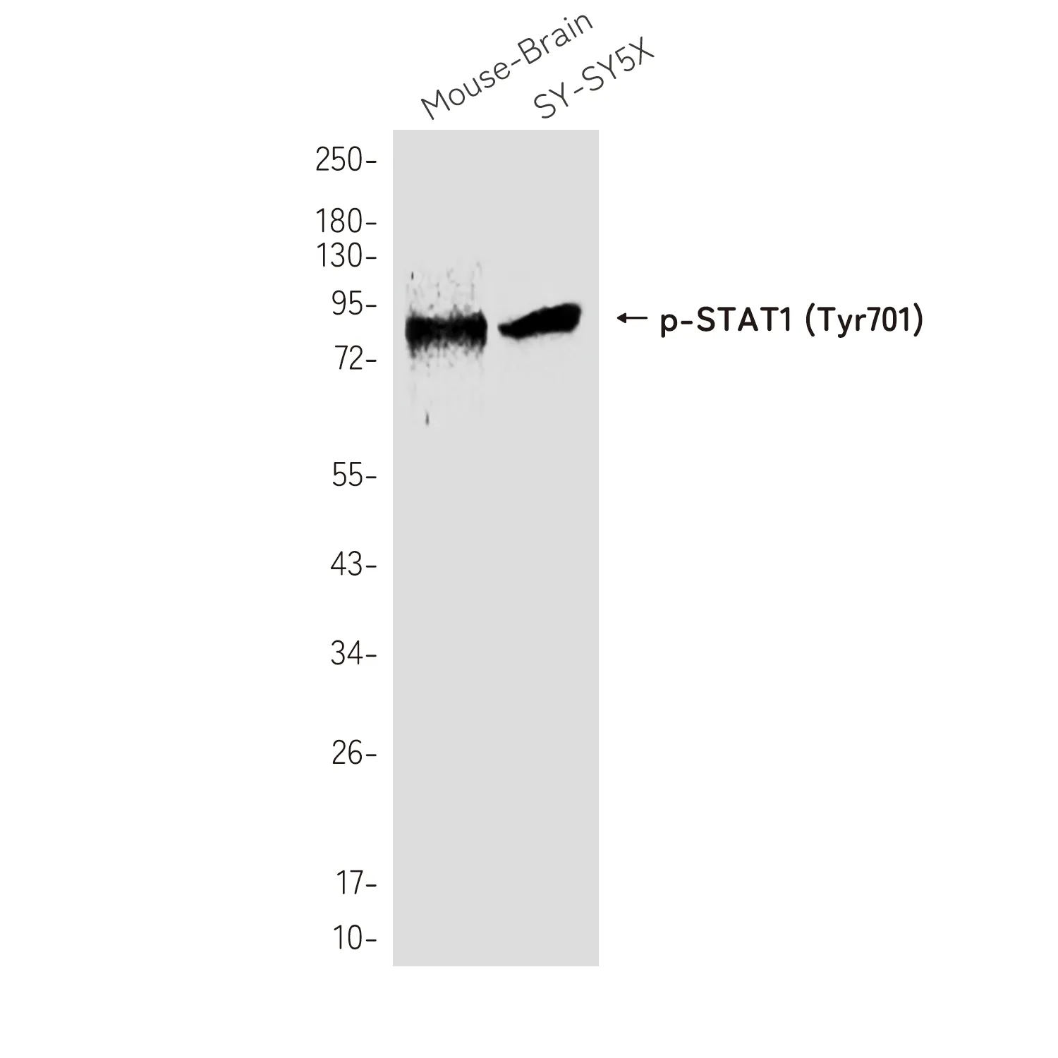 STAT1 Rabbit Polyclonal Antibody - image 1