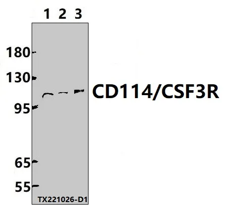 GCSF Receptor (CSF3R) Rabbit Polyclonal Antibody - image 1