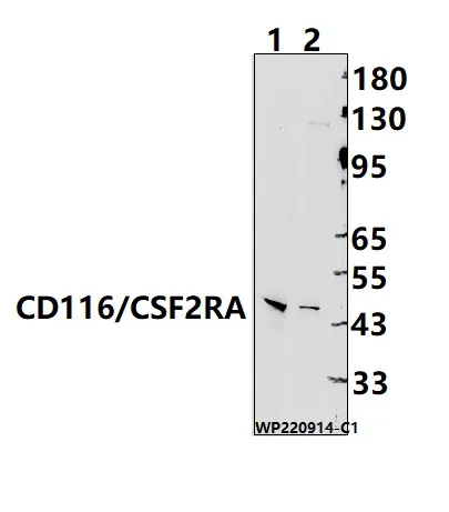 GM CSF Receptor alpha (CSF2RA) Rabbit Polyclonal Antibody - image 1