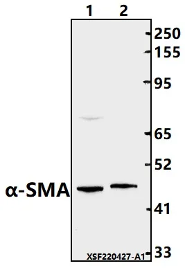 alpha smooth muscle Actin (ACTA2) Rabbit Polyclonal Antibody - image 1