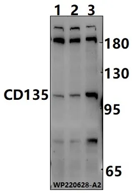 FLT3 Rabbit Polyclonal Antibody - image 1