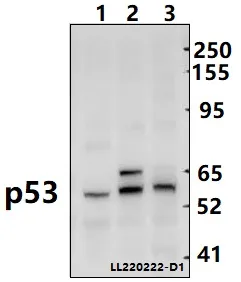 p53 (TP53) Rabbit Polyclonal Antibody - image 1